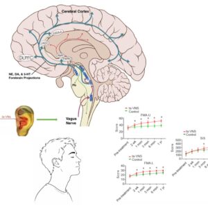 Formation stimulation électrique transauriculaire du nerf vague (ta-VNS)